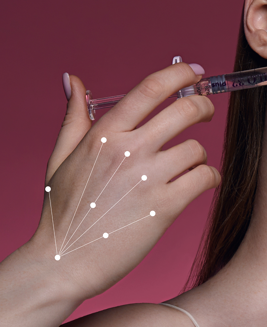 Image illustrating HAND REMODELING treatment results or procedure