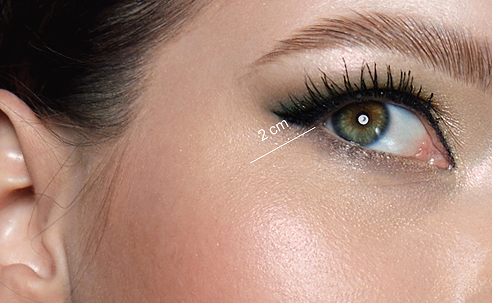 1. ZYGOMATIC PROTRUSION