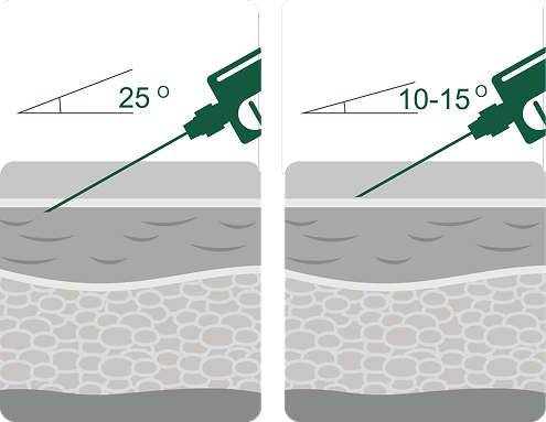 Hilo 32 Treatment Protocol
